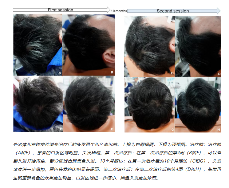144fded7a0dd095fb240ec6a520b1b66.png