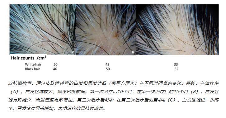 f900b040051d6ff365c9d683fa4fb832.png
